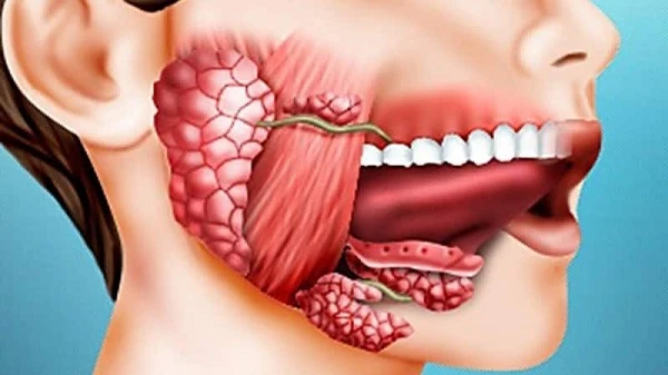 خطرات و عوارض سیالوگرافی